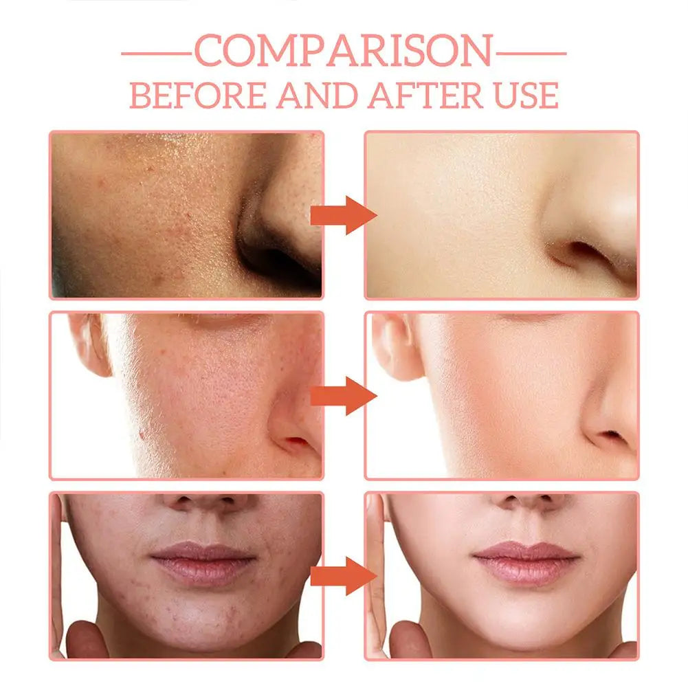 5 In 1 Fade fine lines Firming Face Serum